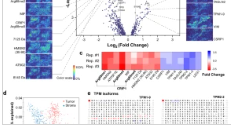 Automated imaging and identification of proteoforms directly from ovarian cancer tissue